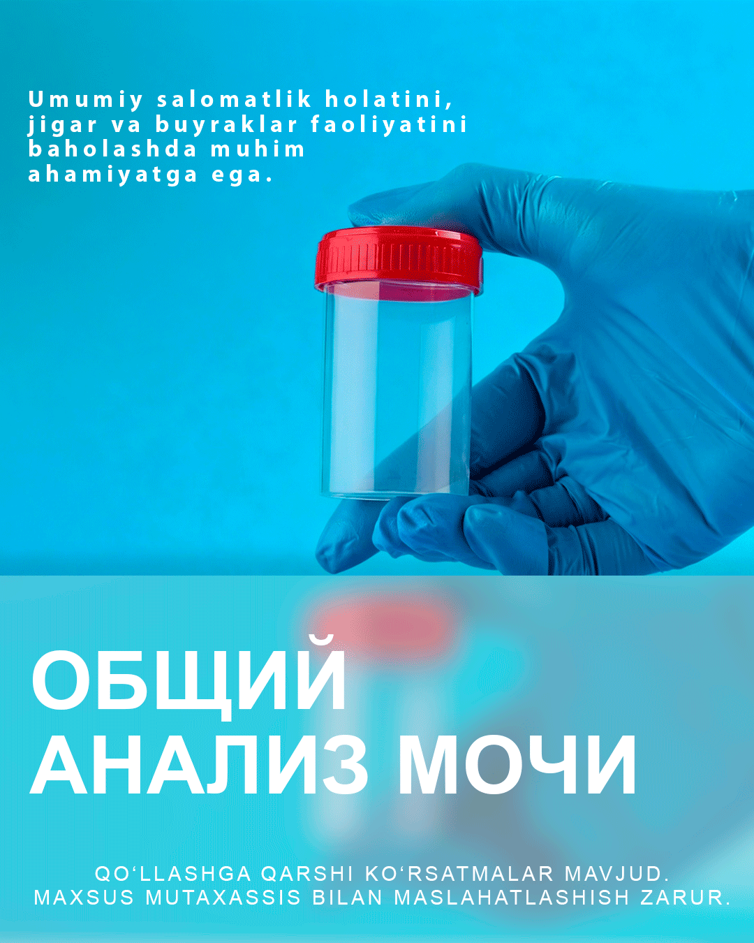 Swiss Lab: Общий анализ мочи (ОАМ)